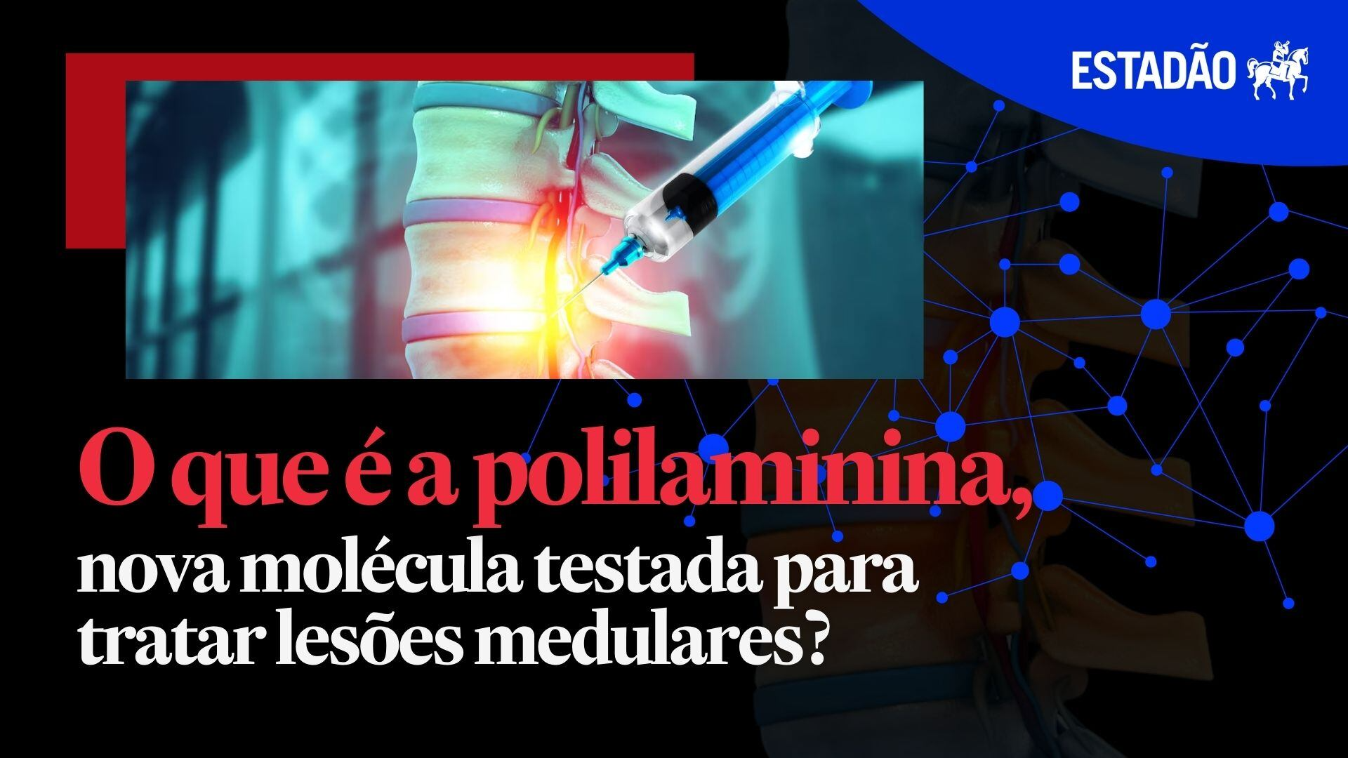 O que é a polilaminina, molécula testada para tratar lesões medulares ...